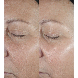 Smart Clinical Repair Serum - Anti-Wrinkle Correcting Serum Smart Clinical Repair Serum - Anti-Wrinkle Correcting Serum